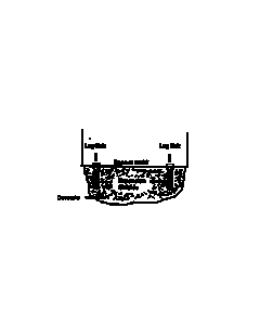 KR55 Anchor Kit